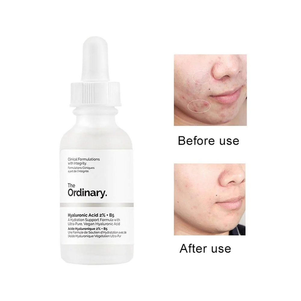 سرم  Hyaluronic Acid 2% + B5 اوردینری